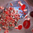 LCHF/Keto und gerinnungshemmende Medikamente (Warfarin)