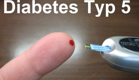 Diabetes Typ 5: Ein neuer Blick auf eine komplexe Stoffwechselerkrankung